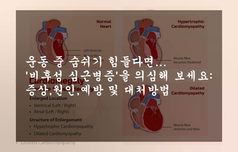 운동 중 숨쉬기 힘들다면...&#39;비후성 심근병증&#39;을 의심해 보세요: 증상&#44;원인&#44;예방 및 대처방법