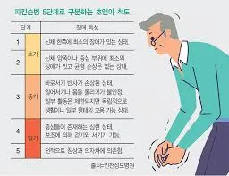 파킨슨병 초기증상