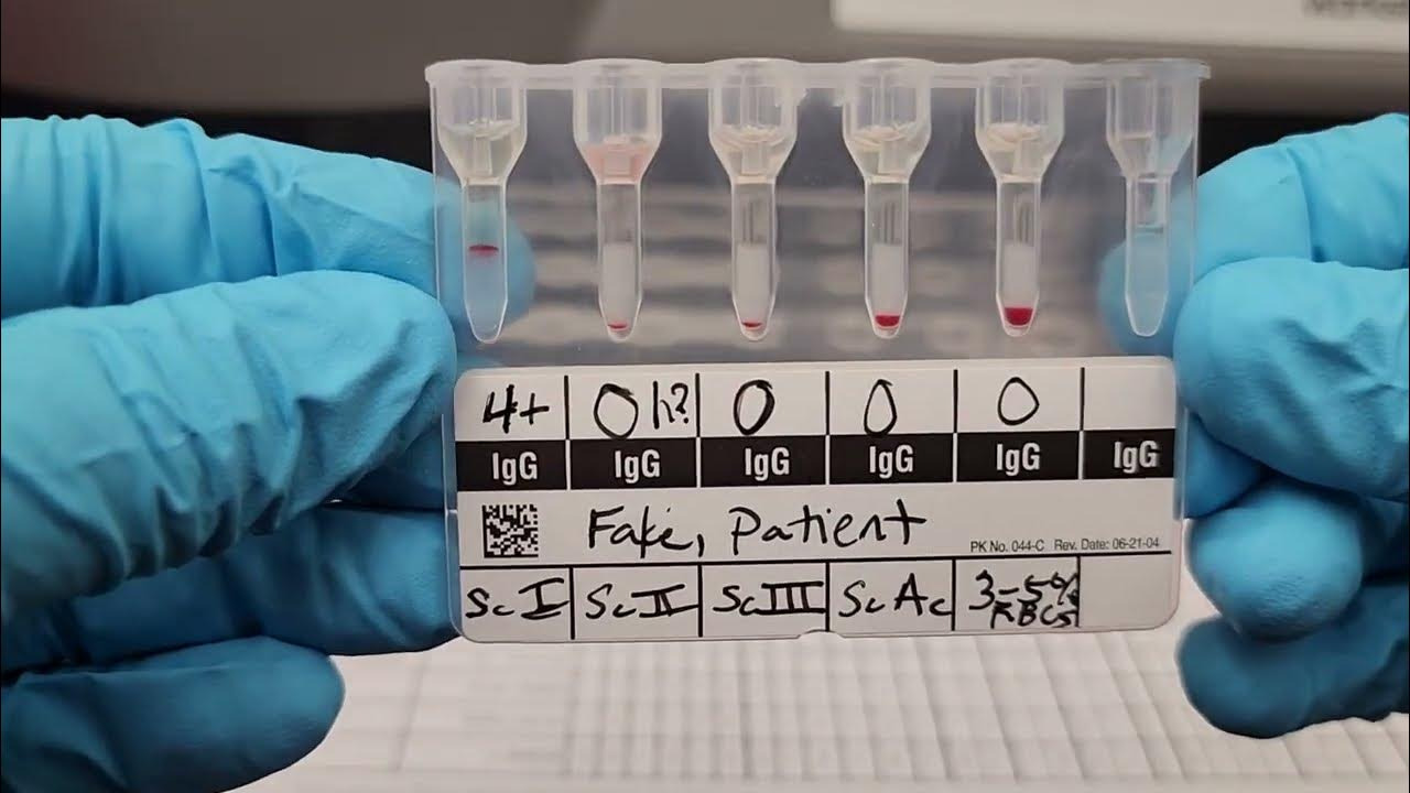pretransfusion-tests