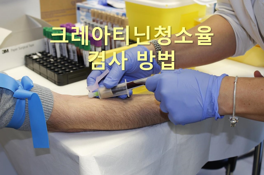  신장 기능을 파악할 수 있는 크레아티닌청소율 검사 방법