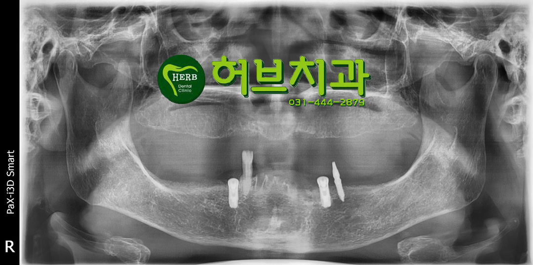 허브치과 이미지
