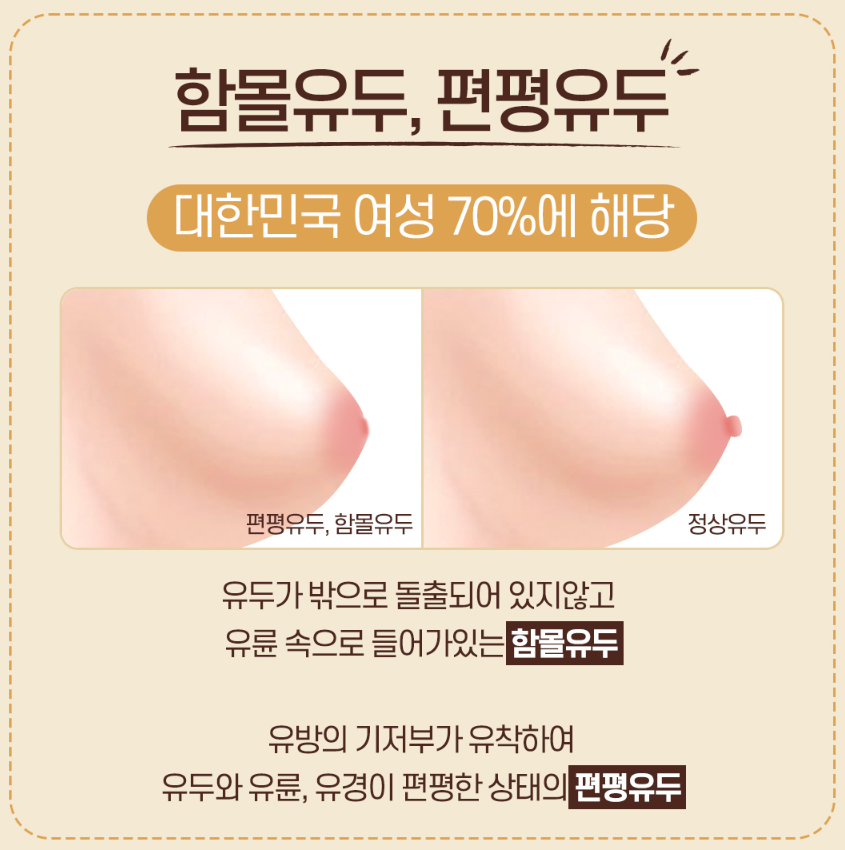 함몰유두 모유 수유? 수술 생각하시는 분만 [필독]