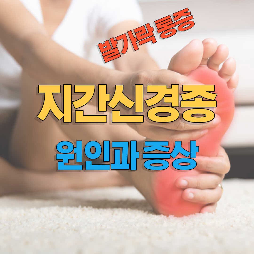  발가락 찌릿찌릿 하거나 발가락 통증이 있다면 지간신경종 의심