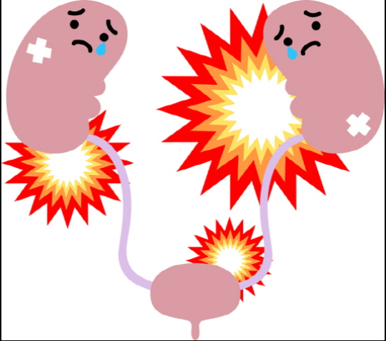신장이 안좋으면 나타나는 증상 7