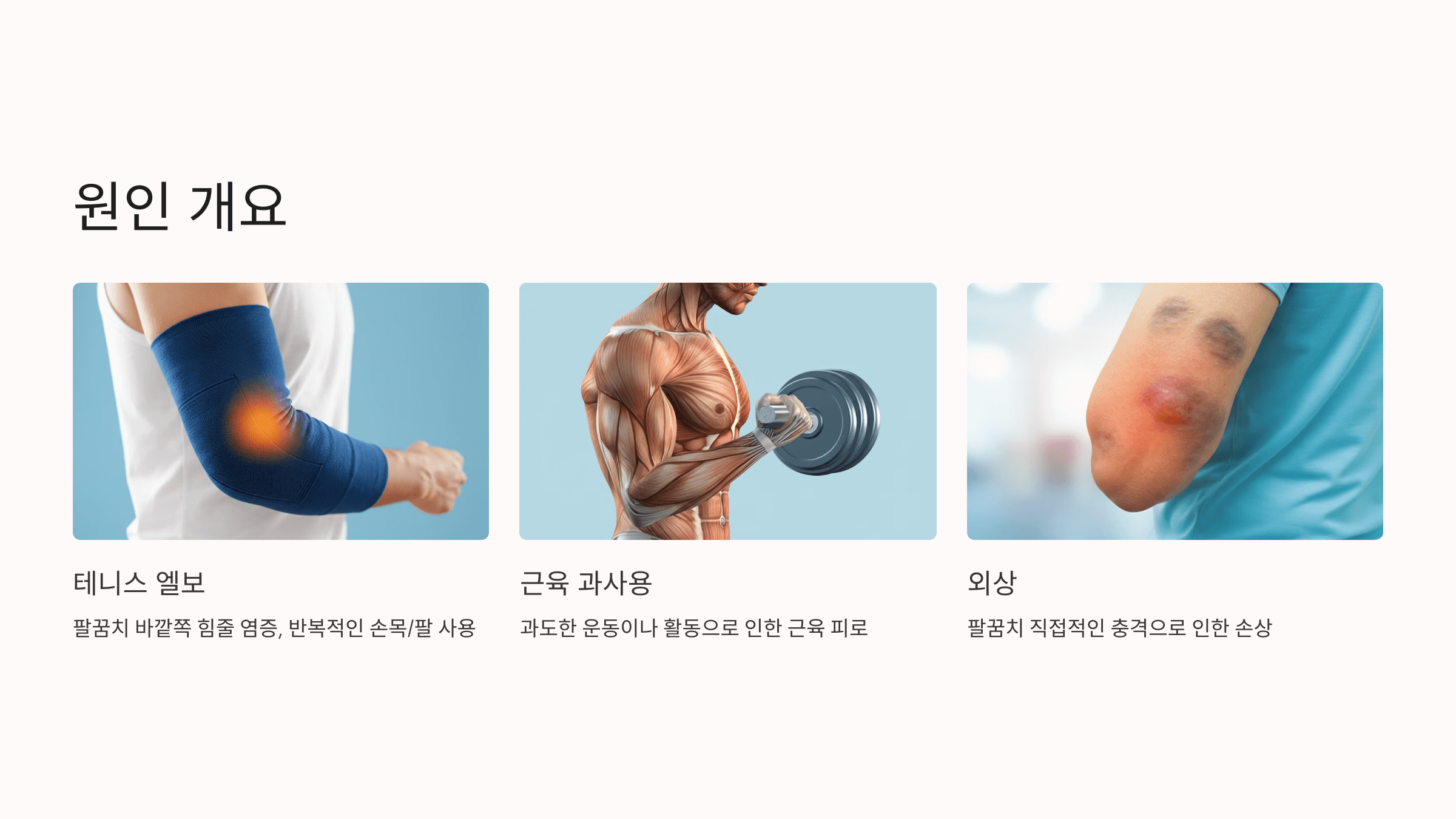 팔꿈치 사진입니다.