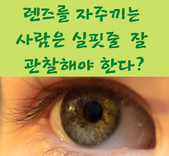  렌즈를 자주끼는 사람은 실핏줄 잘 관찰해야 한다?