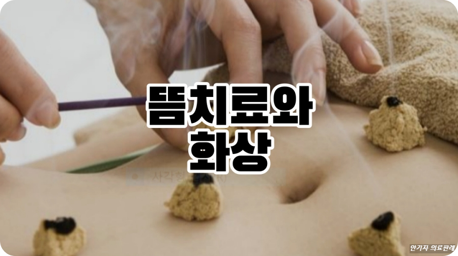 뜸치료로 인한 화상 발생사건