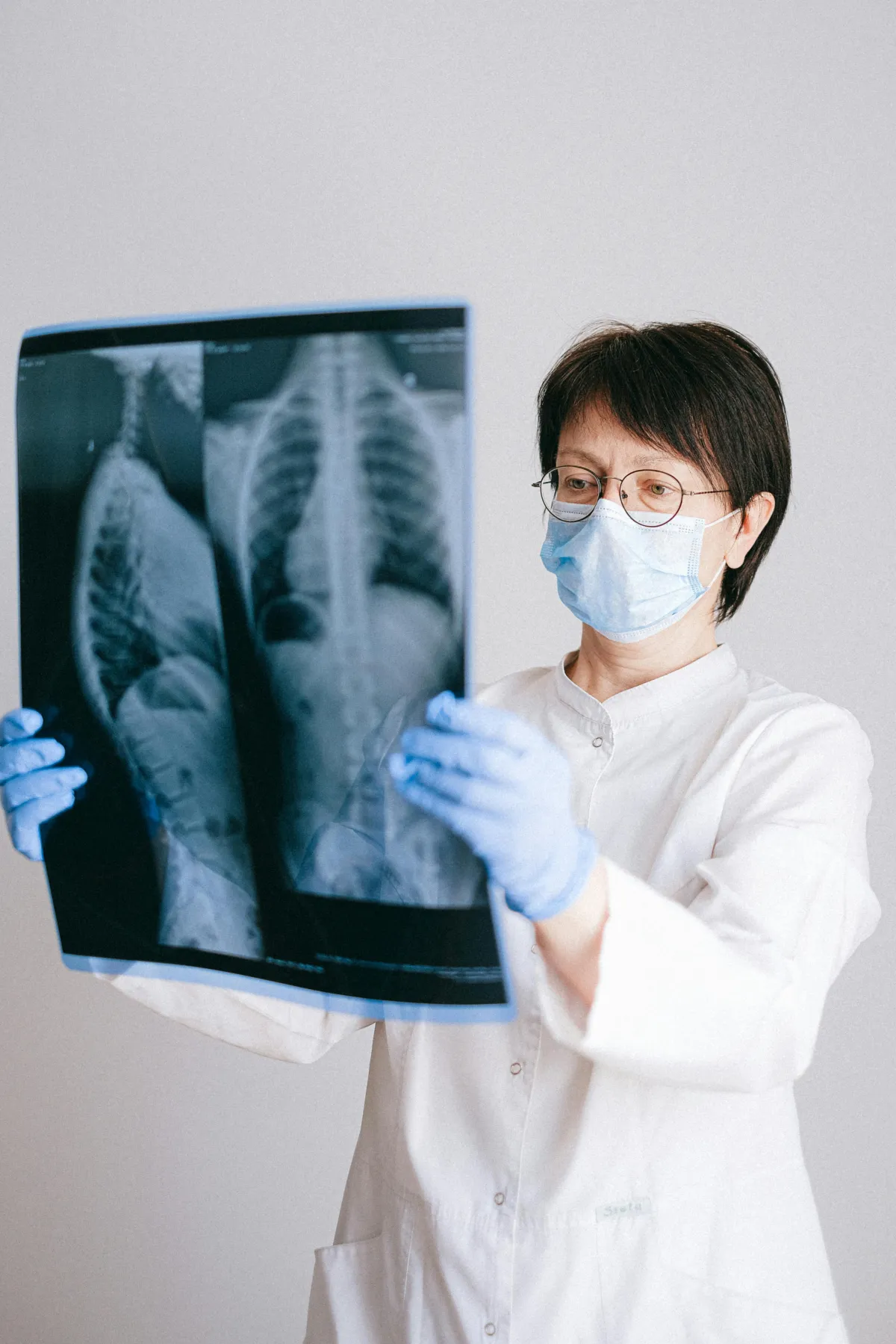 폐 x-ray엑스레이 사진을 보는 의사