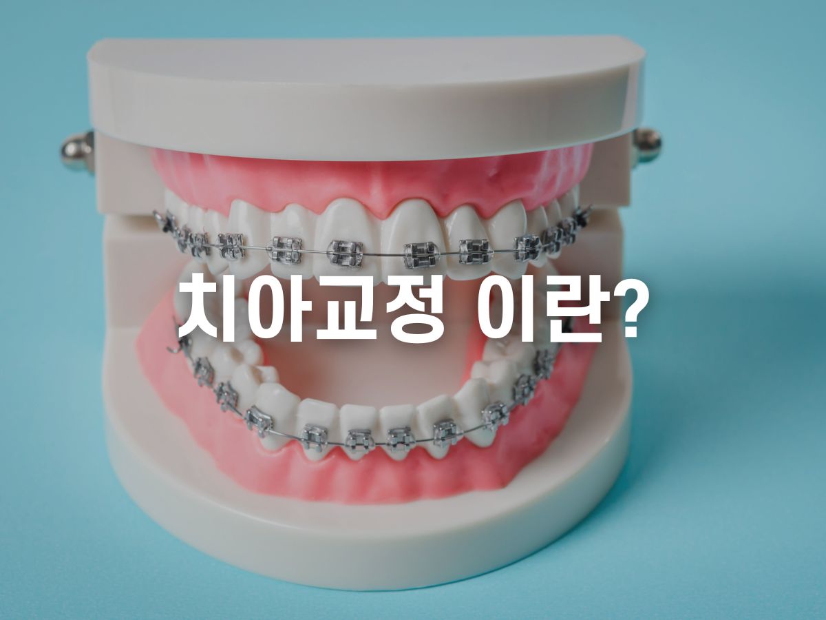 치아교정 이란