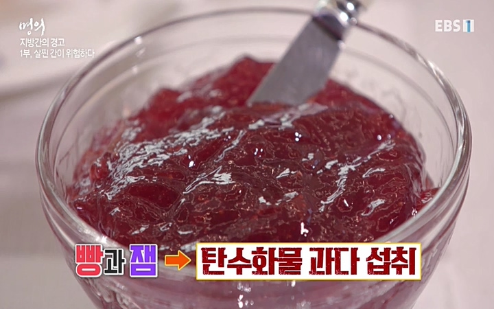 명의_ 제 764회 〈지방간의 경고 1부, 살찐 간이 위험하다〉_ 220429.avi_20220503_193646.057.jpg