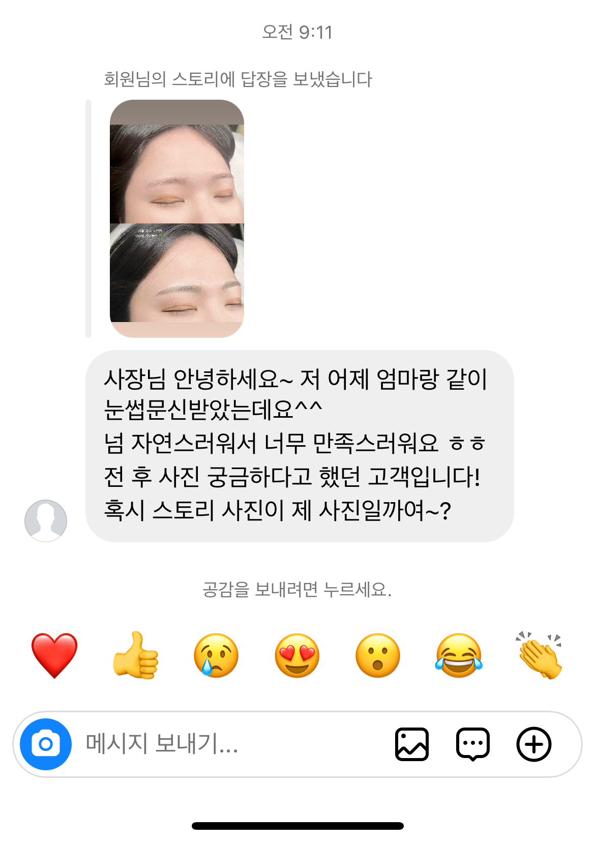 샤르망 이미지