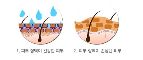 피부장벽-건강한피부-손상된피부-비교사진