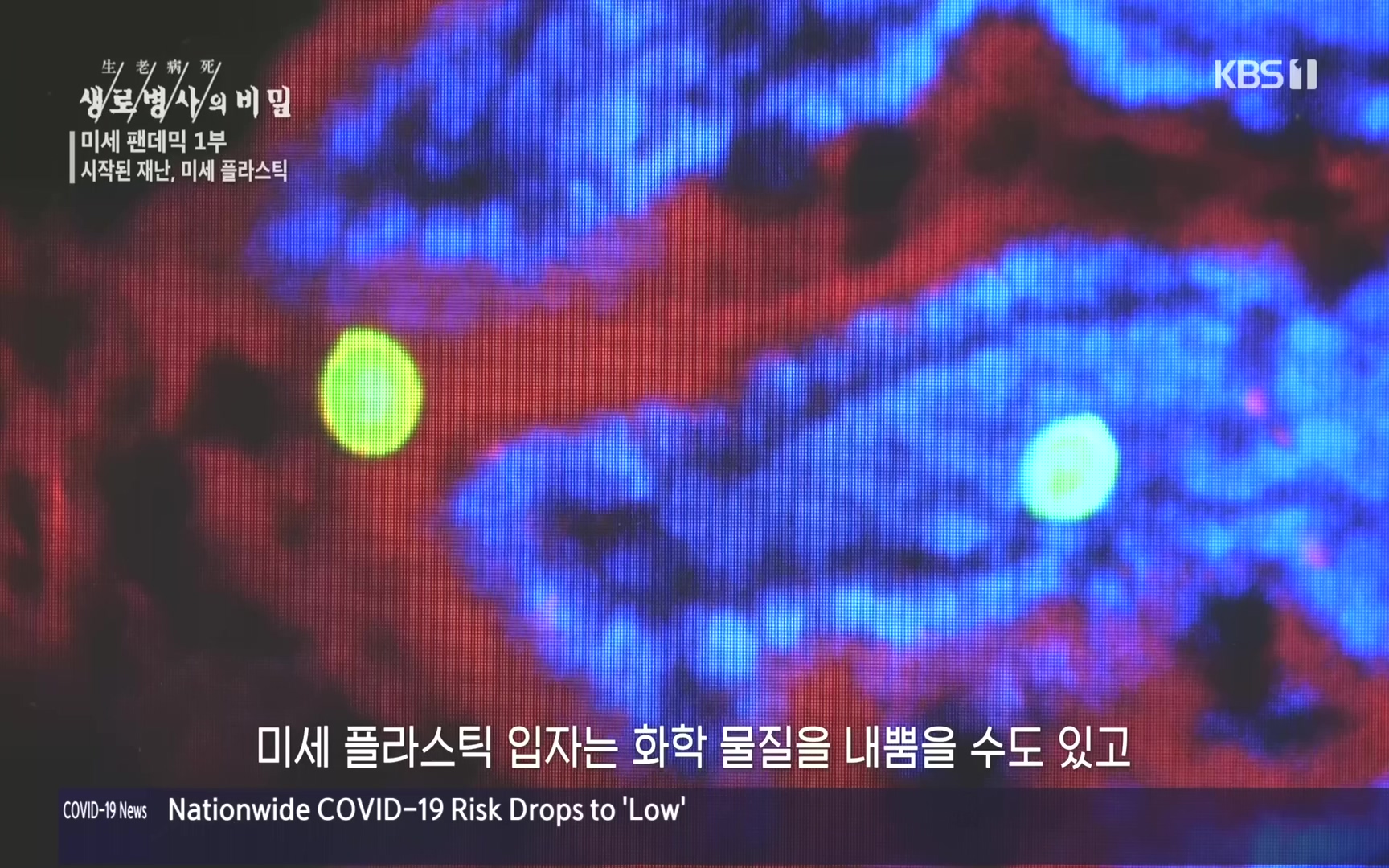 생로병사의 비밀.E839.221012p.H264-F1RST.mp4_20221013_202021.616.jpg