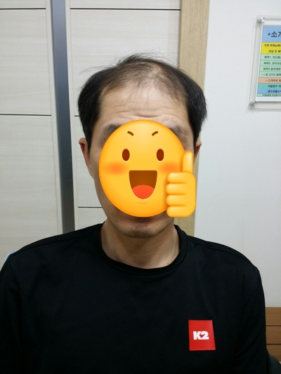센스모 이미지