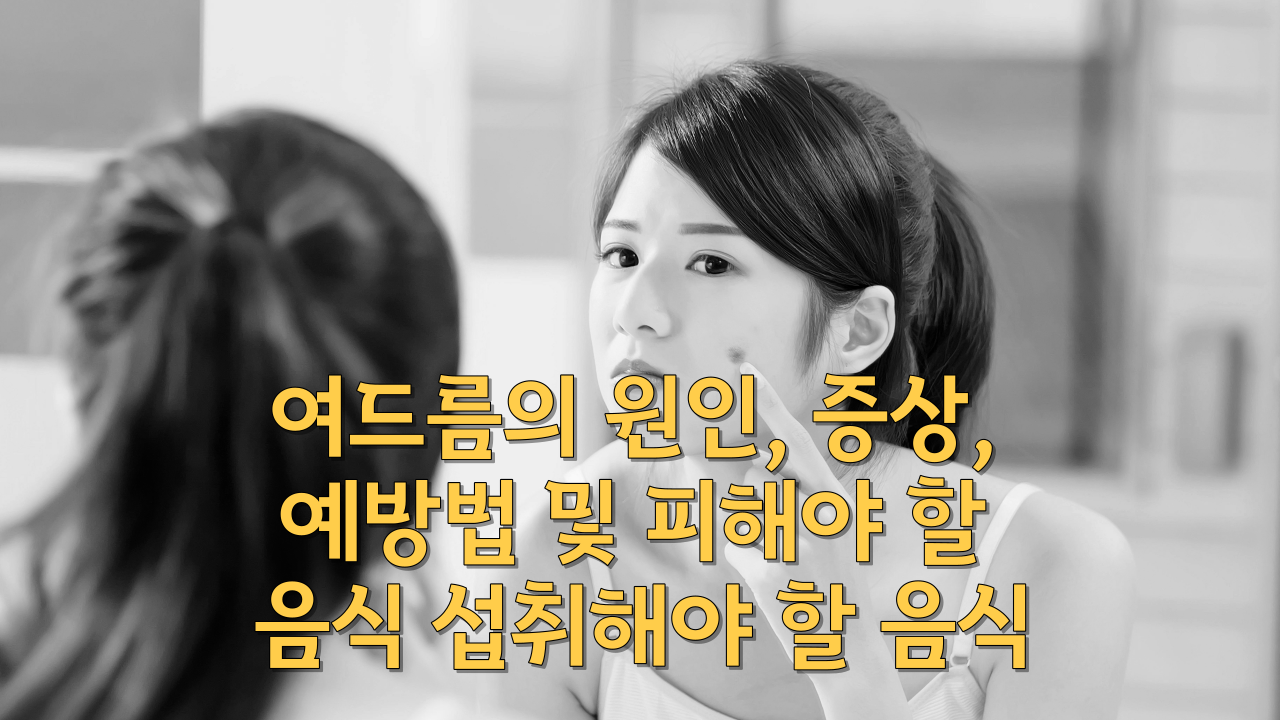  여드름의 원인, 증상, 예방법 및 피해야 할 음식 섭취해야 할 음식