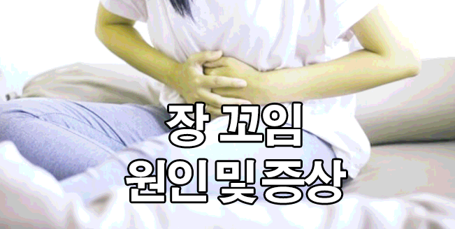  장 꼬임 증상 및 원인 : 장이 뒤틀리는 느낌
