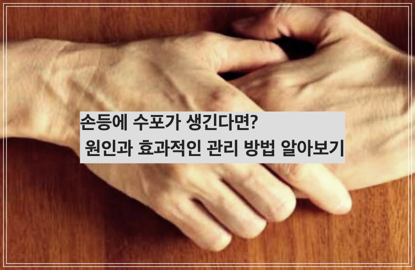 손등에 수포가 생긴다면? 원인과 효과적인 관리 방법 알아보기