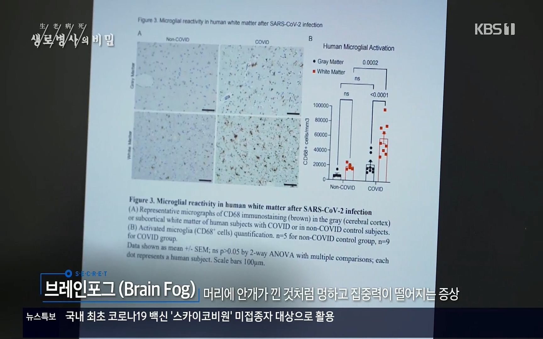 생로병사의 비밀.E827.220720p.H264-F1RST.mp4_20220721_201910.892.jpg