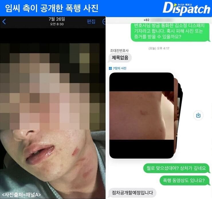 야구선수-김하성-폭행-논란-증거-사진-디스패치