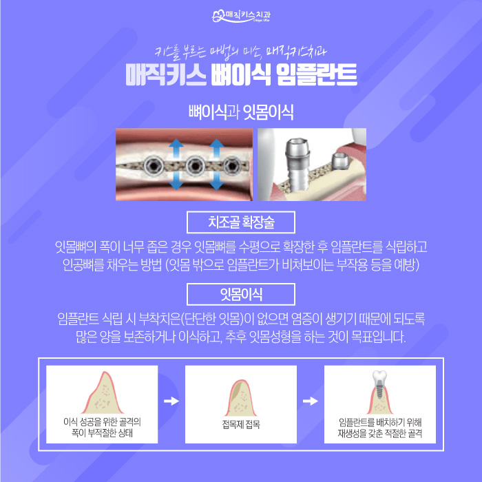 치과추천