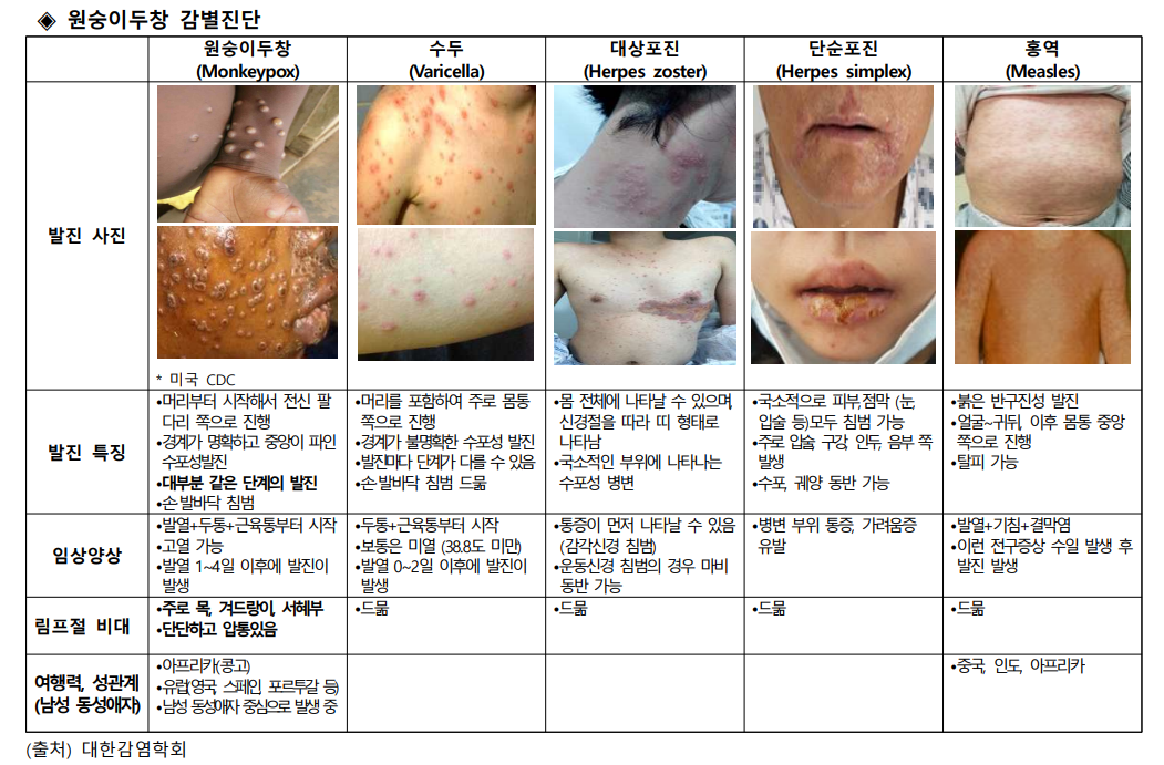 원숭이두창감별진단사진