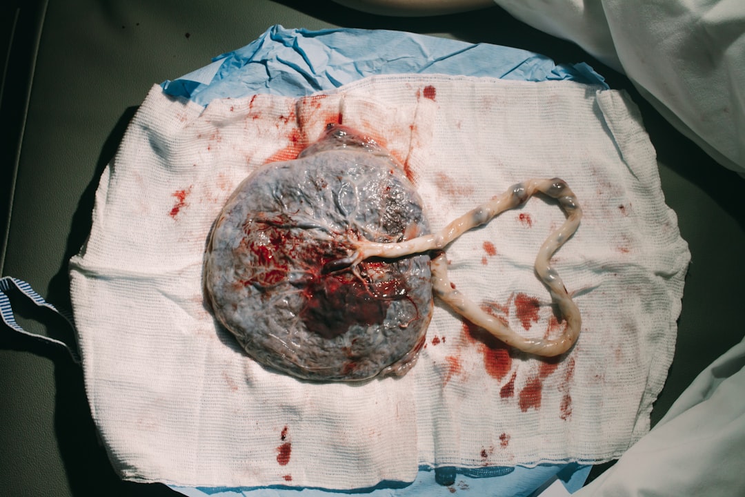 Birth.