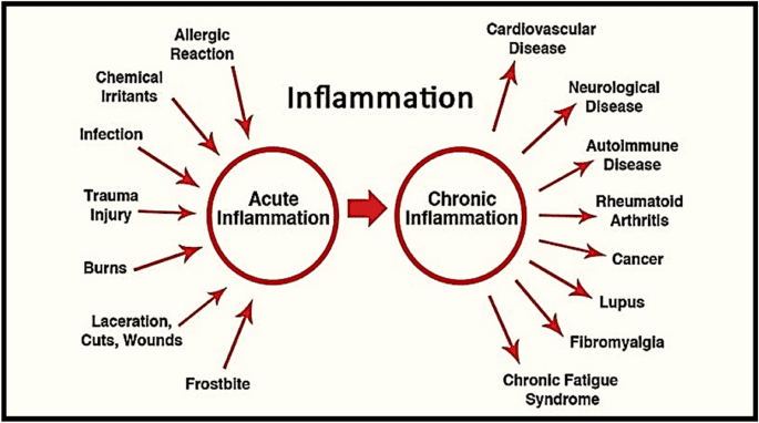 염증만 잘 관리 해도 ‘건강수명’ 대폭 늘어난다 What is the difference between acute inflammation and chronic inflammation?