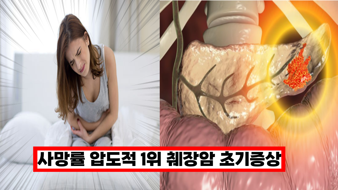  '이때 발견하면 늦어요' 20~30대도 많이 발생하는 사망률 1위 췌장암 초기 증상 5가지