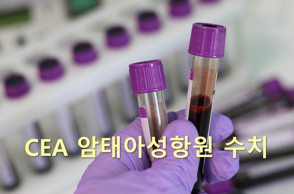  소화기관의 암을 조사하는 CEA 암태아성항원 수치