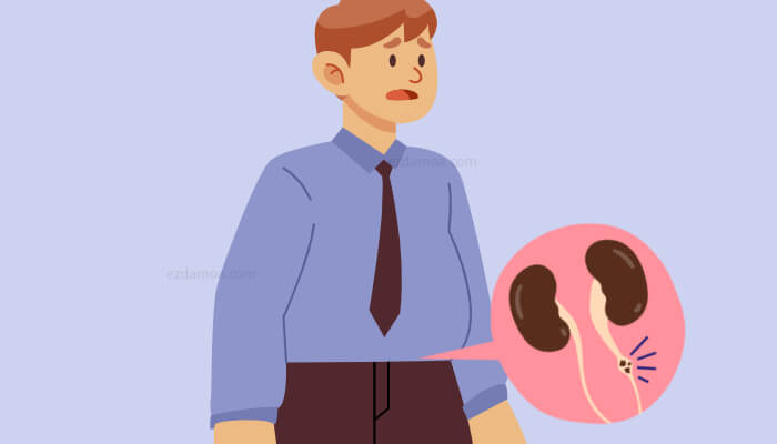 요로 결석의 원인