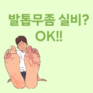 발톱무좀 실비가능 썸네일