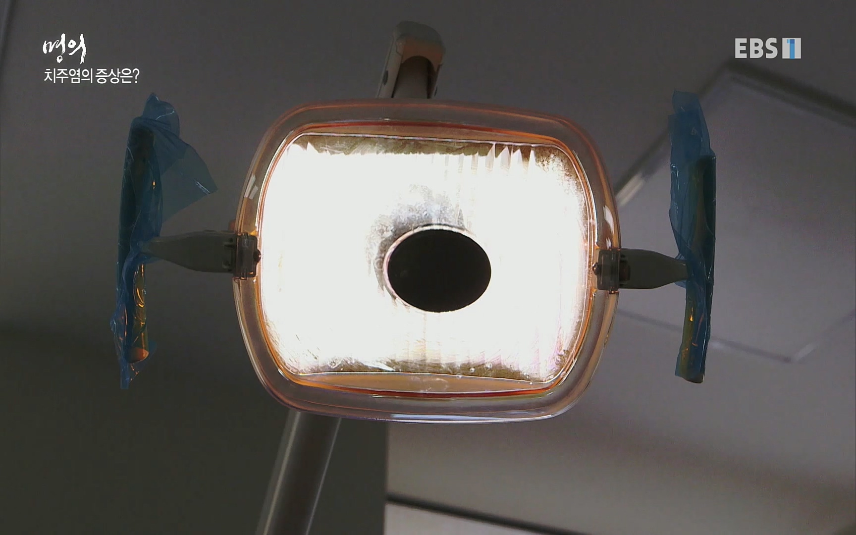 EBS 명의 헬스케어 - TV - 교육의 중심 EBS치주염이 코로나로 소홀해진 구강관리가 치아를 더 망가트리고 위험하게 만들며, 증상이 없기 때문에 특히 더 조심하고 치은염 단계에서 진행되지 않도록 예방해야한다 정의원 교수님과 치_20220505_151711.647.jpg