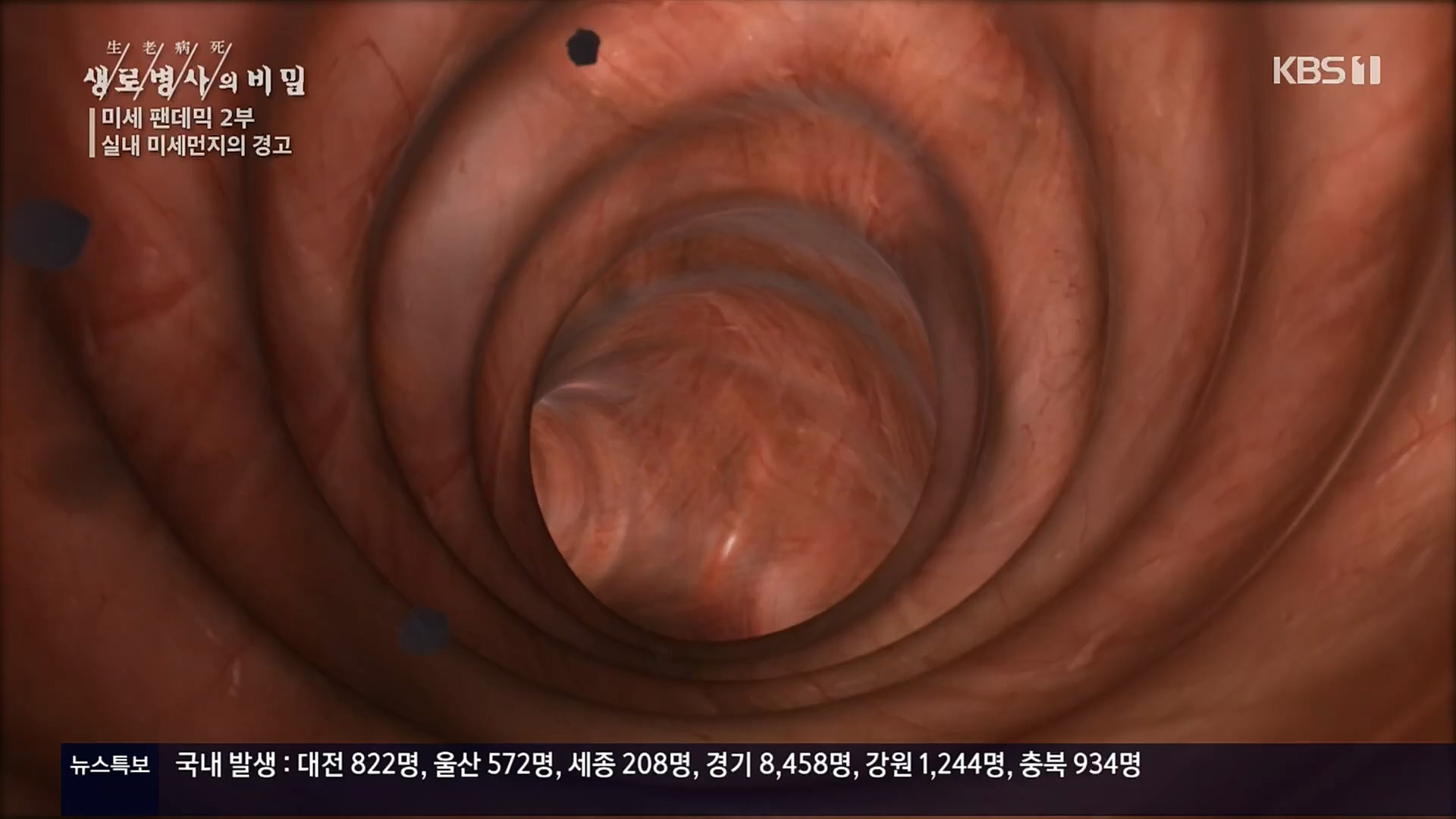 생로병사의 비밀.E840.221019p.H264-F1RST.mp4_20221020_180925.584.jpg