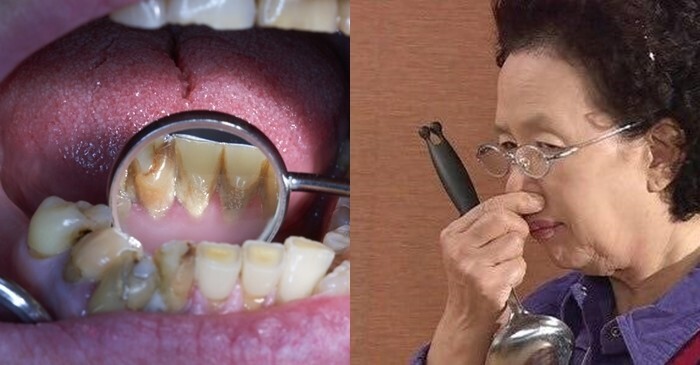 클린택 스마트 음파 전동칫솔 소문난 혁명템 매일 스케일링 하는 기분
