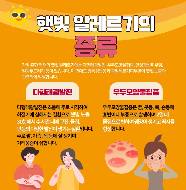 햇빛알레르기 종류