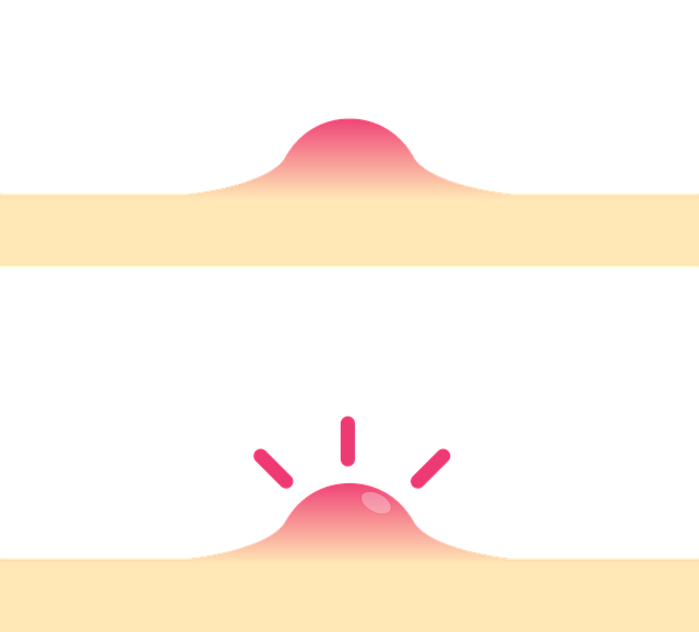 염증