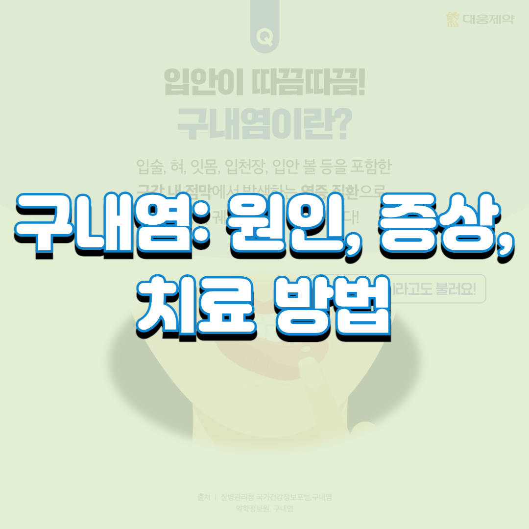  구내염: 원인, 증상, 치료 방법