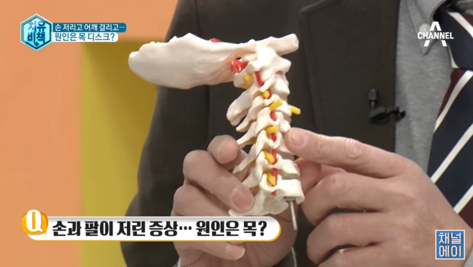  목디스크 증상 팔저림 두통