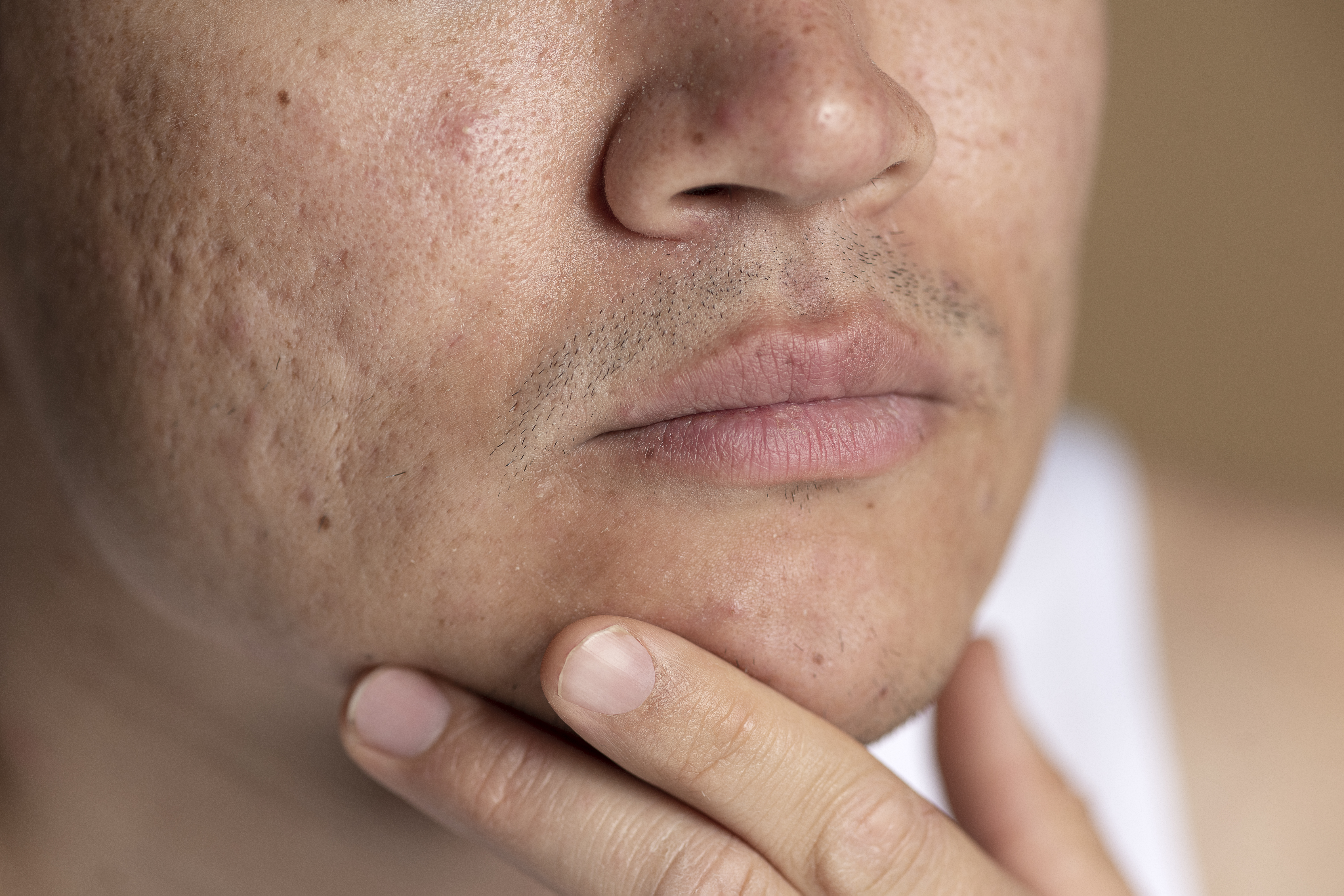 얼굴 붓는 이유 면도&#44; 알레르기&#44; 치아농양&#44; 혈관부종 등 관련일 수도있다는 연구결과