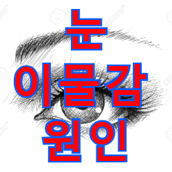  눈 이물감 원인과 해결방법은?(Feat. 안구건조증)