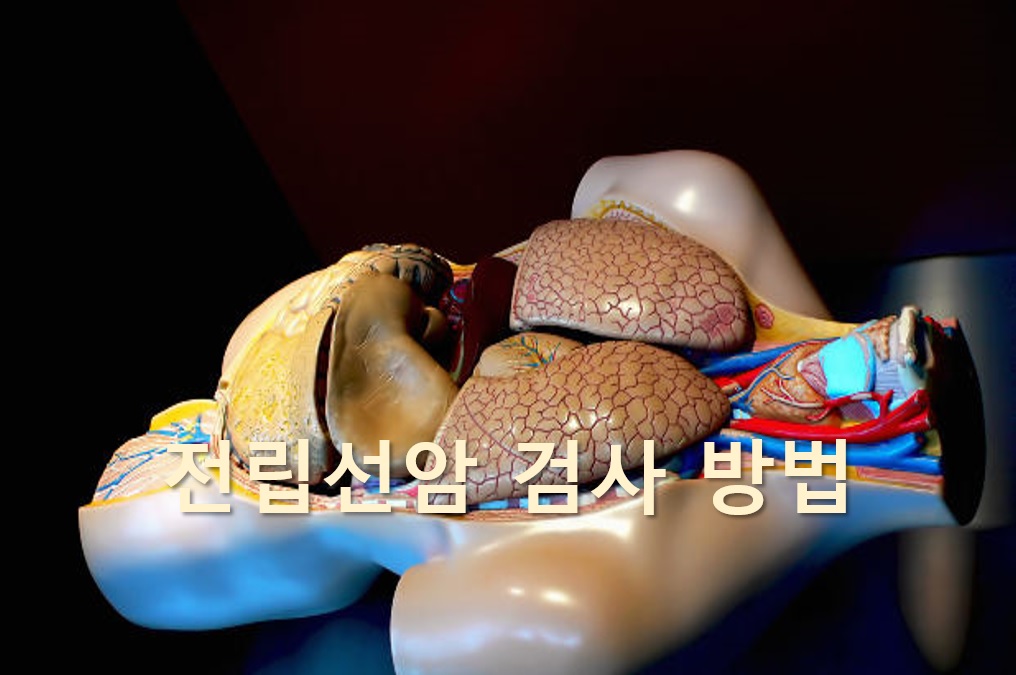  전립선암을 진단하는 전립선암 검사 방법