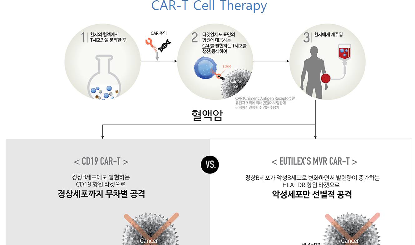 유틸렉스 CAR-T 치료제