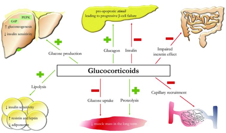 glucocorticoid induced hyperglycemia
