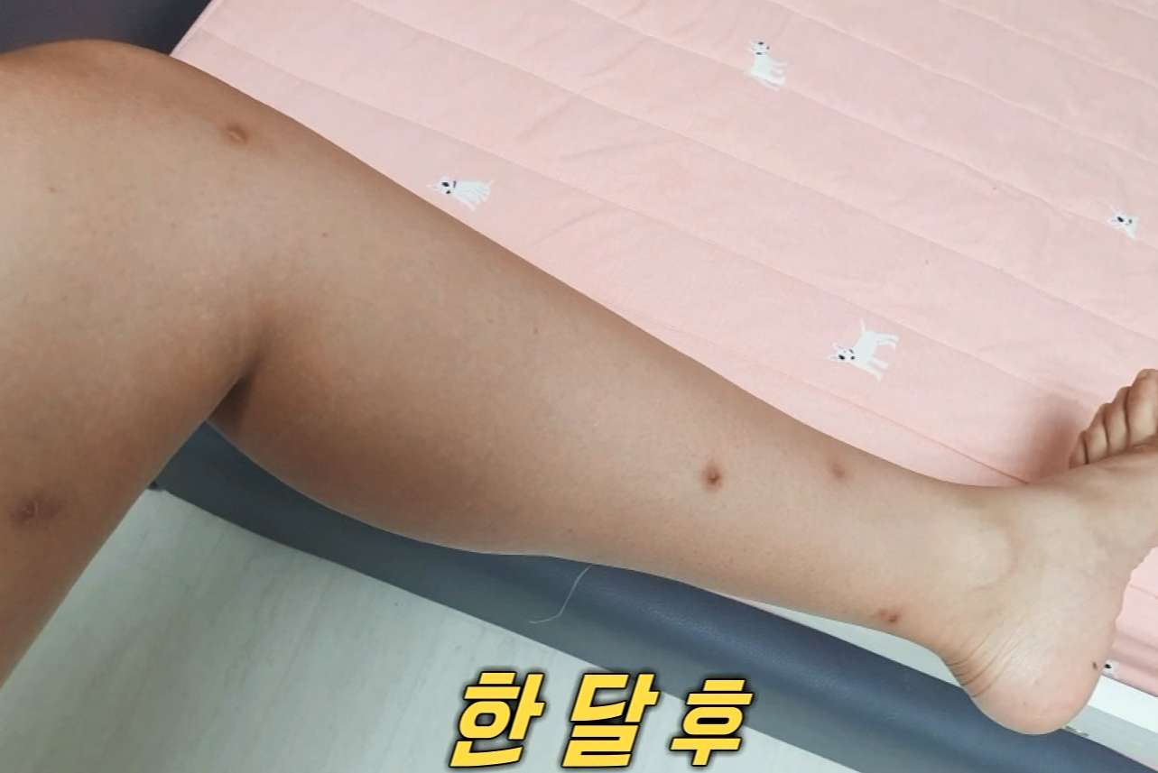 모기보다 무서운 흡혈 파리, 먹파리(블랙플라이)에 대하여 모기보다 무서운 흡혈 파리, 먹파리(블랙플라이)에 대하여
