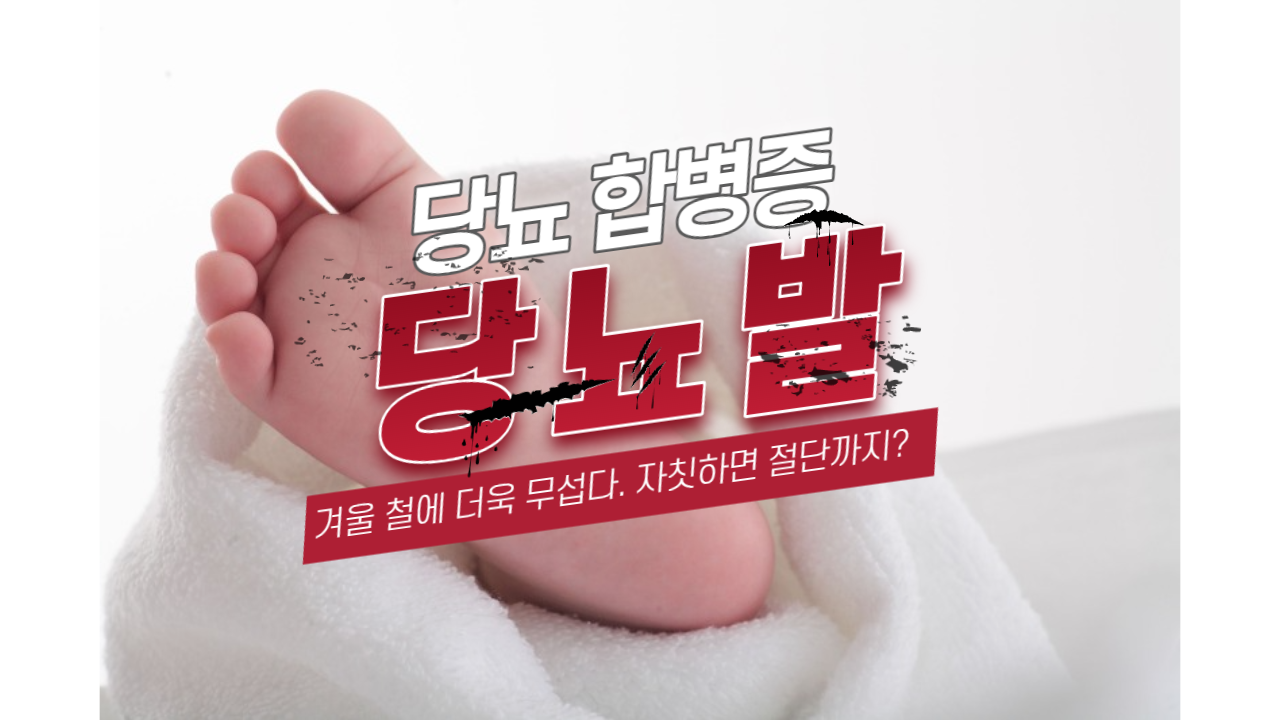  겨울 철 당뇨 합병증 관리 : 절단을 부르는 당뇨 발이란 무엇인가?