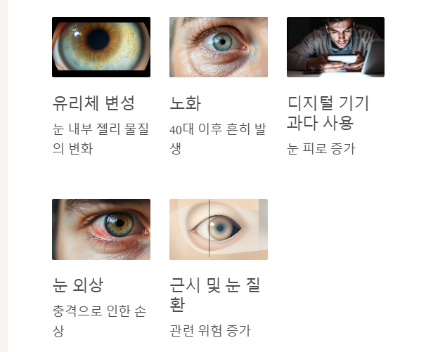 비문증 없애는 법