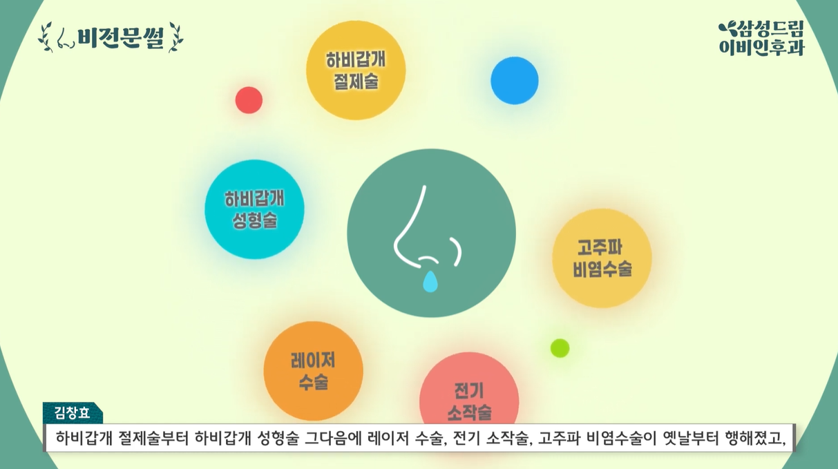 하비갑개 수술 종류1