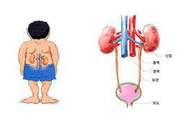 콩팥이 안 좋으면 나타나는 증상