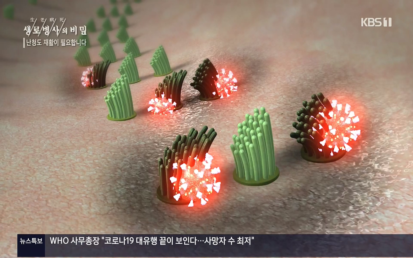 생로병사의 비밀.E837.220928p.H264-F1RST.mp4_20220930_212506.081.jpg