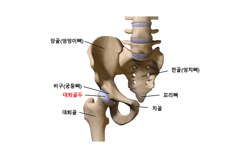  고관절통증 (대퇴골두 무혈성괴사, 고관절염, 고관절골절)